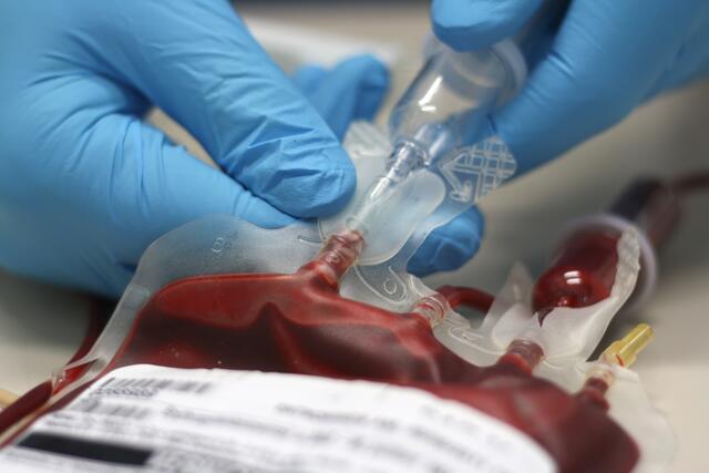 Bluttransfusionen werden tagtäglich am Universitäts­klinikum benötigt - für vielfältige Operationen und Behandlungen. Den Bedarf zu decken, wird ­immer schwieriger. | Foto: sebgross/Stock.Adobe.com