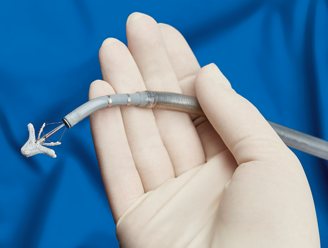 Beim Mitraclipping wird die Undichtigkeit der Herzklappe durch das Einsetzen eines oder mehrerer sogenannter „Clips“, die an eine Art Wäscheklammer erinnern, wieder verschlossen.  | Foto: Klinikum