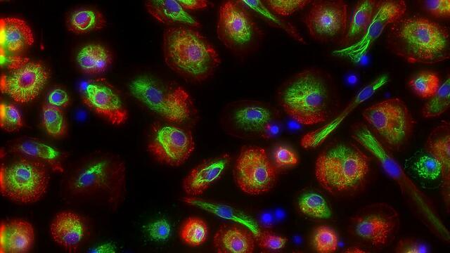 FLUMIAS: Unter Schwerelosigkeit "live" in Zellen schauen. | Foto: Deutsches Zentrum für Luft- und Raumfahrt (DLR),