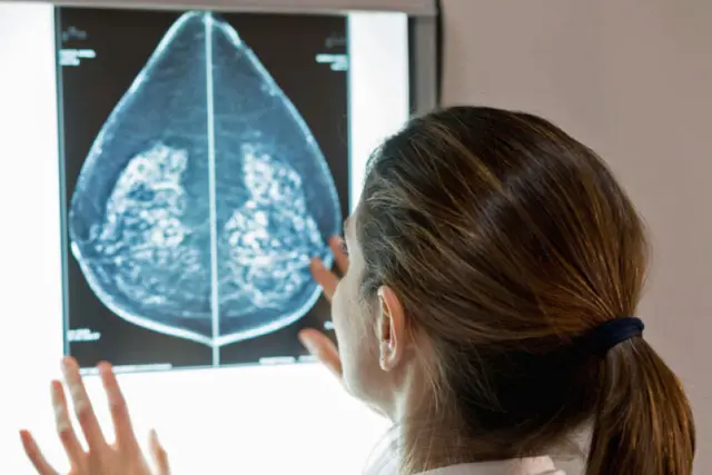 Die Überlebenschancen von Brustkrebs-Patientinnen und -Patienten haben sich dank neuer Entwicklungen und Fortschritten in der Therapie deutlich verbessert. Foto: DJD/www.brustkrebs.de/Getty Images/andresr